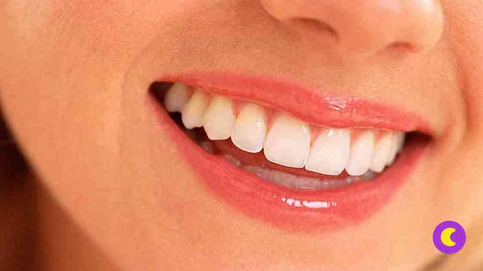 Виниры: красивые зубы без отбеливания 