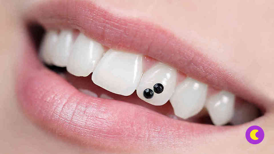 Скайсы: модные искусственные бриллианты для зубов